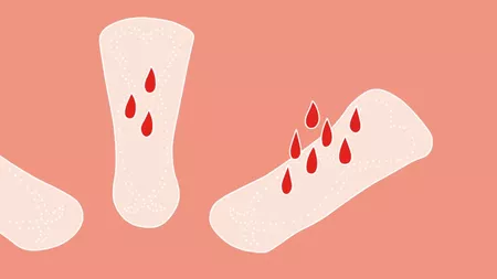 Sângerări între menstruații. Când trebuie să apelezi la un specialist?
