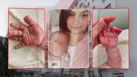 Pițipoancele de la Spitalul „Sf. Maria” din Iași „mutilează” bebelușii! Priviți mânuța unui copil, după ce a scăpat din unghiile asistentei. Mama: „L-a stors de mână ca pe un burete ca să curgă sânge”