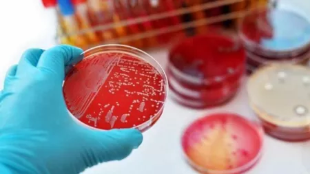 După o absenţă de aproape 40 de ani, difteria, o boală extrem de contagioasă, a fost depistată în Europa