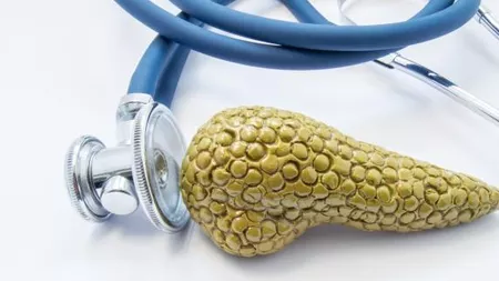 Pancreatita acută se vindecă? Iată ce tratament medicamentos recomandă medicii și care sunt cele mai bune remedii naturiste pentru această afecțiune