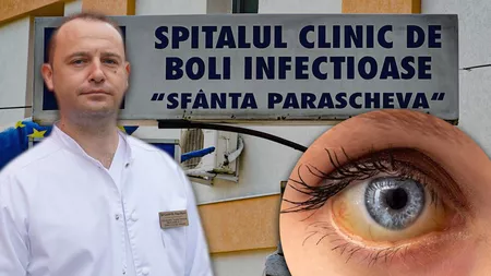 Caz de leptospiroză, înregistrat la un pacient de 21 de ani! Dr. Florin Roșu: „A fost diagnosticat precoce, deși s-a prezentat la spital când boala de care suferea era în formă agravată!”