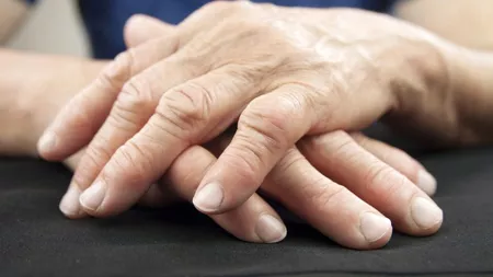 Care este diferența dintre artrită și artroză? Explicațiile medicului Dan Cionca - VIDEO