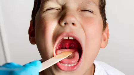 Iată o listă cu remedii pentru durerea de gât la copii