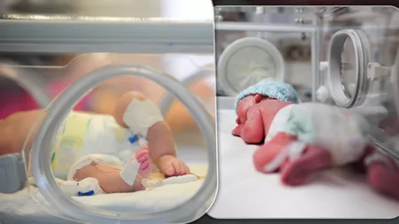 La Iași, în decurs de câteva luni, 553 de copii s-au născut prematur. Cel mai mic bebeluș care se află în grija medicilor de la Maternitatea „Cuza Vodă” are 850 de grame - FOTO