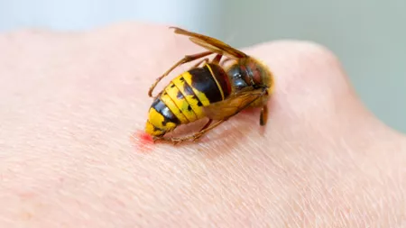 Înțepătura de viespe este periculoasă? Ce spun medicii