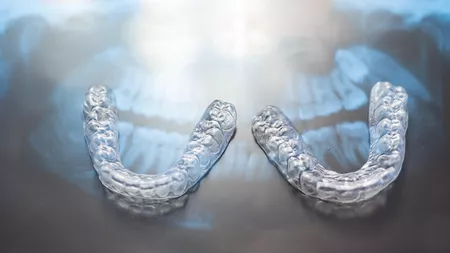 De ce să alegi un aparat dentar invizibil? Cinci avantaje importante