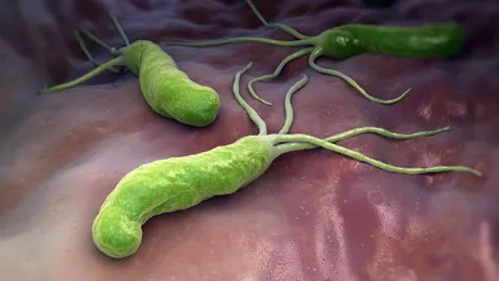 Helicobacter pylori - Tot ce trebuie sa stii