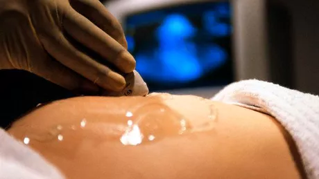 Cum poti sa-i faci asa ceva unei gravide Experienta socanta in sala de nastere la o maternitate din Iasi