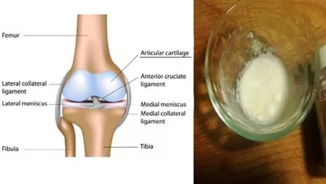 Alcool iod si aspirina. Reteta pe care niciun farmacist nu vrea sa o stiti