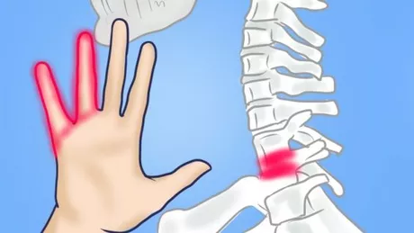 Amortirea mainilor - un semnal important ca trebuie sa mergeti la medic. 7 cauze