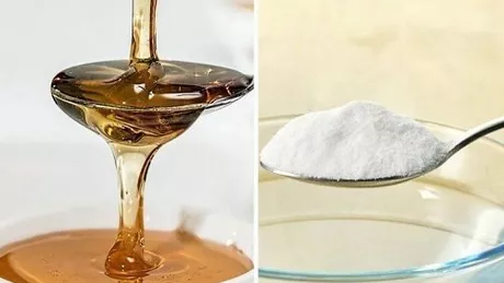 Bicarbonat de sodiu cu miere  6 beneficii si 2 retete