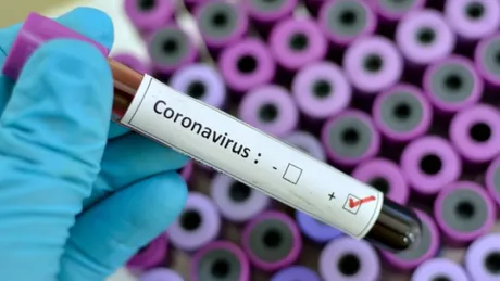 Prefectura din Rimini a făcut anunţul îngrijorător. Un alt cetăţean italian infectat cu coronavirus a vizitat România