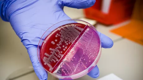 Antibioticul care revolutioneaza lupta impotriva bacteriilor rezistente