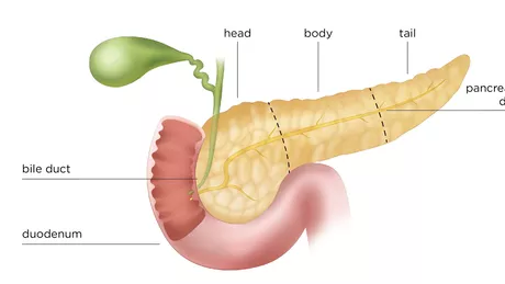 Cum avem grijă de pancreas - Cele mai întâlnite afecţiuni ale pancreasului
