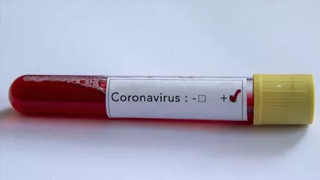 Bilanțul coronavirusului în Olanda 614 persoane infectate și cinci decedate