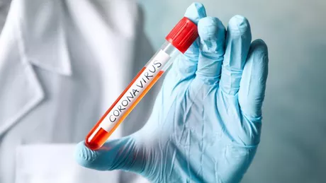 Cercetătorii confirmă. COVID-19 o combinație letală între SARS și HIV