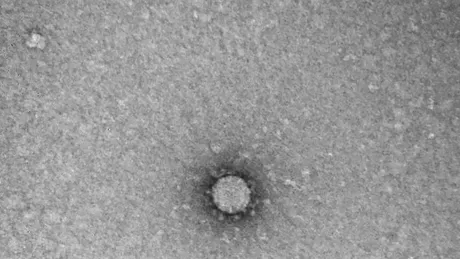 Prima imagine la microscop cu noul coronavirus. Ruşii transmit că ar putea ajuta la găsirea unui vaccin - FOTO