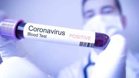 Din informațiile furnizate de Guvernul României patru persoane infectate cu COVID-19 se află la secția de terapie intensivă. Aceștia au o stare generală stabilă