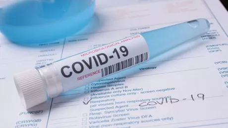 Bilanț coronavirus 25 septembrie 2020 pe raza județului Iași