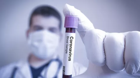 Ambasada Israelului în România Testul de coronavirus cu rezultat în doar un minut