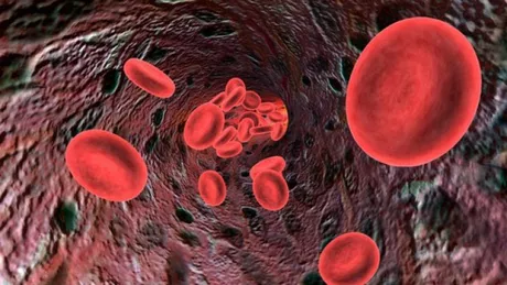 Cum să elimini toxinele din sânge