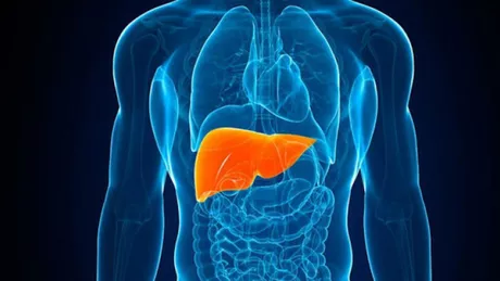 Ce complicatii poate genera ciroza hepatica