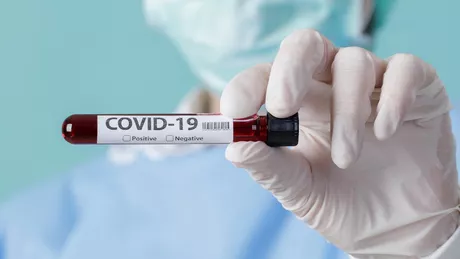 Un medic infectat cu COVID-19 și vindecat îi cere lui Nelu Tătaru testare gratuită