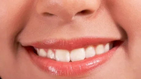 5 obiceiuri bune pentru dinți mai albi