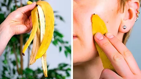 Coaja de banană e bună pentru sănătate. Câteva întrebuințări despre care nu știați