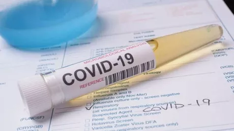 România a înregistrat un nou record al cazurilor de Covid-19. La Iași 181 de persoane au fost confirmate cu noul coronavirus - GRAFICE