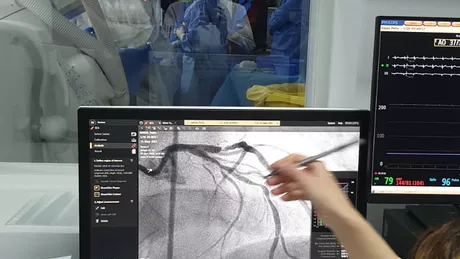 Prima coronarografie s-a realizat la Clinica de Cardiologie de la Spitalul Sf. Spiridon Iași