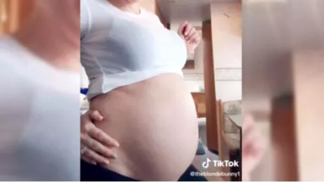Caz rar în SUA. O femeie care era gravidă a rămas din nou însărcinată. Cum explică medicii fenomenul