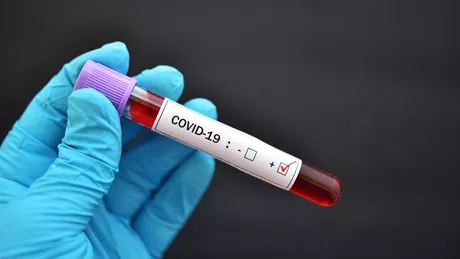 Un potențial medicament pentru COVID-19 are succes în studiile de laborator