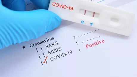 Anticorpii neutralizanți pot dispărea în două luni în formele moderate de Covid-19