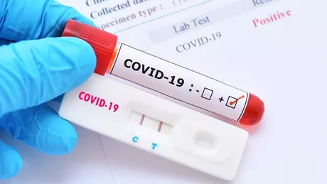 Aproximativ 20 de pacienți au fost internați a doua oară din cauza reinfectării cu coronavirus în Iași Medicii atenționează însă că numărul pacienților reinfectați poate crește odată cu răspândirea noilor tulpini