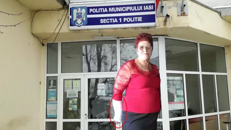 Toată baza în polițiștii din Iași O femeie a fost bătută în Piața Voievozilor iar de un an se roagă de oamenii legii să i se facă dreptate Mi-a rupt mâna am avut 65 de zile de îngrijiri medicale și nimeni nu face nimic