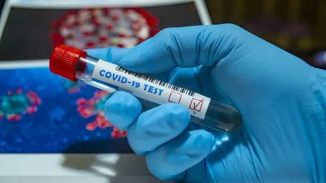Persoanele care s-au imunizat natural împotriva COVID-19 nu transmit boala afirmă Centrul pentru Controlul și Prevenirea Bolilor din SUA