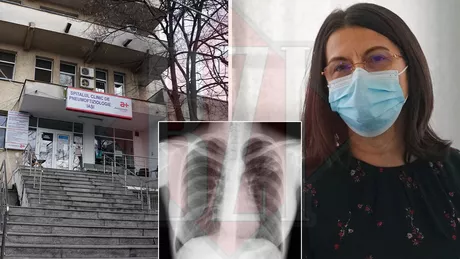 Numărul pacienților Covid-19 care ajung la Spitalul de Pneumoftiziologie din Iași cu sechele pulmonare severe este în scădere