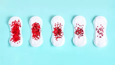 Cheaguri de sânge la menstruație. Care sunt cauzele acestora și când devin periculoase