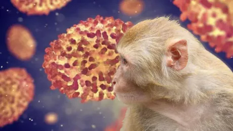 Francezii au început vaccinarea împotriva variolei maimuţei