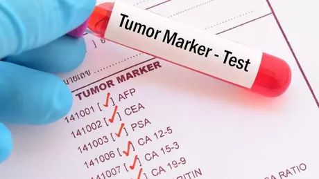 Valori normale markeri tumorali. Afecțiuni care pot fi identificate datorită acestora
