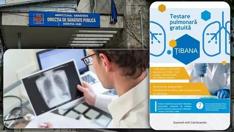 Peste 1.500 de ieșeni au beneficiat de screening gratuit pentru depistarea tuberculozei