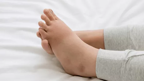Antiinflamator pentru picior umflat. 11 modalități simple pentru a rezolva această problemă
