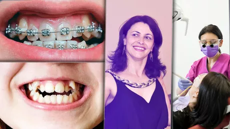 Aparatul dentar a devenit o necesitate pentru majoritatea copiilor Este un lux pentru că lumea așa îl percepe dar niște dinți aliniați sunt niște dinți sănătoși - FOTO