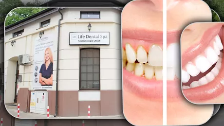 Ajutor pentru elevi și studenți. Până pe data de 11 septembrie Life Dental Spa oferă reduceri considerabile la serviciile stomatologice