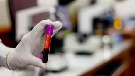 Ce boli depistează hemoleucograma În ce situații este prescris testul sanguin