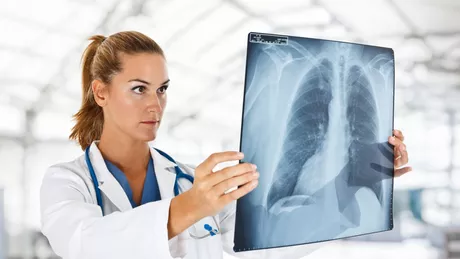Atelectazie sau sindromul de condensare pulmonară retractila Care sunt cauzele