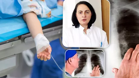 La Iași încă nu se poate vorbi de transplant pulmonar. Dr. Cristina Grigorescu Este scump și nu avem spațiul pentru a desfășura o activitate medicală de asemenea anvergură - FOTO