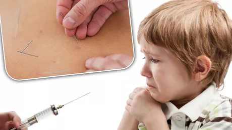 Medicul Doru Baltag tratează enurezisul la copii prin electropunctură Metoda nu este dureroasă. Va suporta un impuls electric de intensitate slabă - FOTO