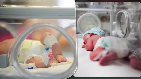 La Iași în decurs de câteva luni 553 de copii s-au născut prematur. Cel mai mic bebeluș care se află în grija medicilor de la Maternitatea Cuza Vodă are 850 de grame - FOTO